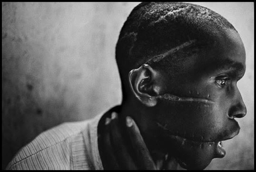James Nachtwey - Rwanda, 1994